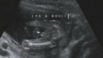 15 weeks pregnant ultrasound #2