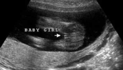 16 weeks pregnant ultrasound #1