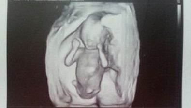 16 weeks pregnant ultrasound #2