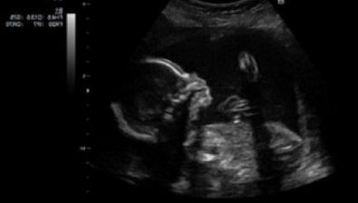 21 weeks pregnant ultrasound #2