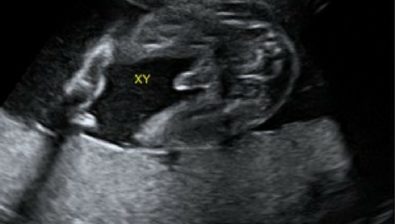 26 weeks pregnant ultrasound #1