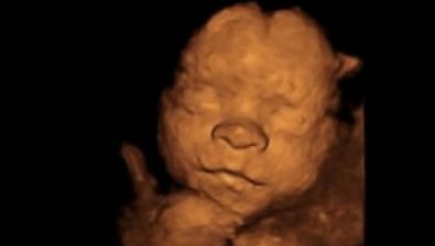 26 weeks pregnant ultrasound #2