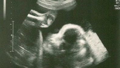 26 weeks pregnant ultrasound #3