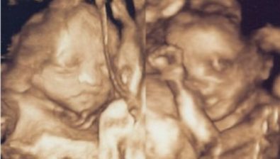 26 weeks pregnant ultrasound #4