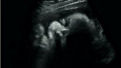 31 weeks pregnant ultrasound #1