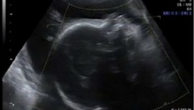 31 weeks pregnant ultrasound #2