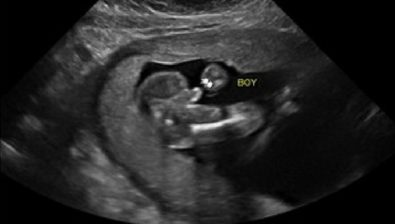 31 weeks pregnant ultrasound #3