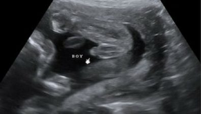 31 weeks pregnant ultrasound #4
