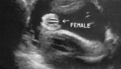 34 weeks pregnant ultrasound #1