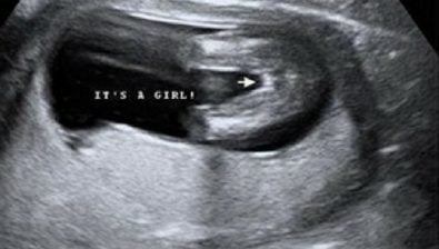 34 weeks pregnant ultrasound #2