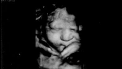 34 weeks pregnant ultrasound #3
