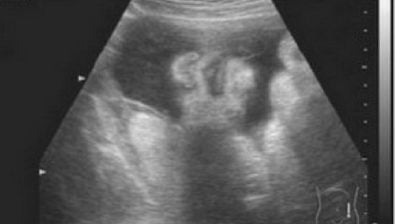 34 weeks pregnant ultrasound #4