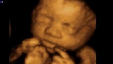 38 weeks pregnant ultrasound #2