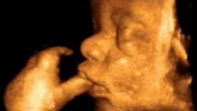 41 weeks pregnant ultrasound #1