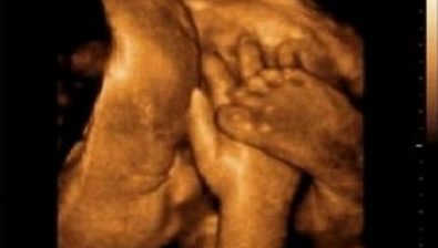 41 weeks pregnant ultrasound #2