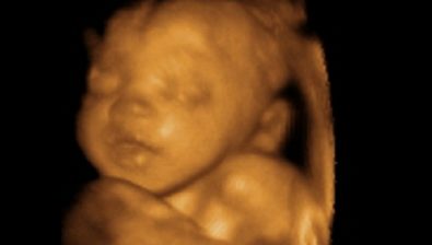 41 weeks pregnant ultrasound #3