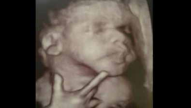 41 weeks pregnant ultrasound #4