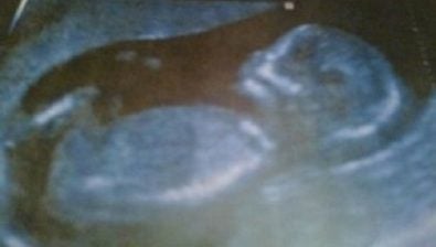 14 weeks pregnant ultrasound #1