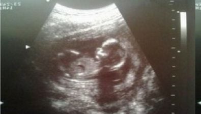 14 weeks pregnant ultrasound #2