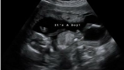 14 weeks pregnant ultrasound #3