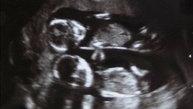 14 weeks pregnant ultrasound #4