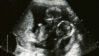 16 weeks pregnant ultrasound #4