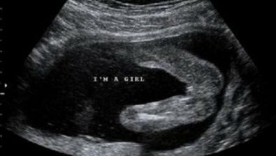 17 weeks pregnant ultrasound #3