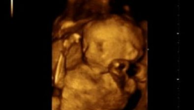 25 weeks pregnant ultrasound #1