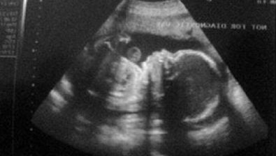 25 weeks pregnant ultrasound #2