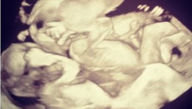 25 weeks pregnant ultrasound #3