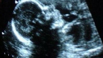 32 weeks pregnant ultrasound #1