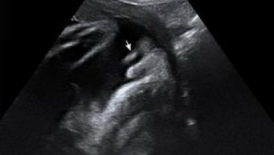 32 weeks pregnant ultrasound #2