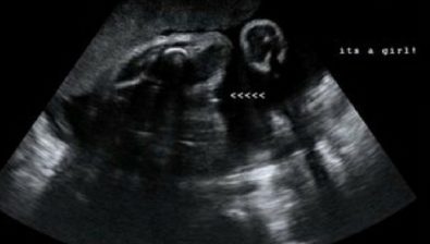 32 weeks pregnant ultrasound #3