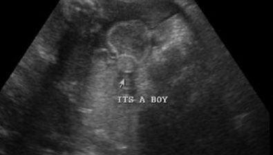 32 weeks pregnant ultrasound #4
