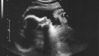 35 weeks pregnant ultrasound #2