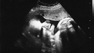 35 weeks pregnant ultrasound #3