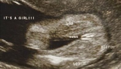 35 weeks pregnant ultrasound #4