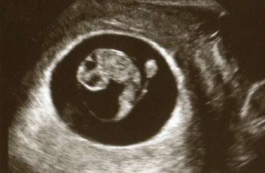 Week normal ultrasound 8 7