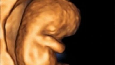 9 weeks pregnant ultrasound #4